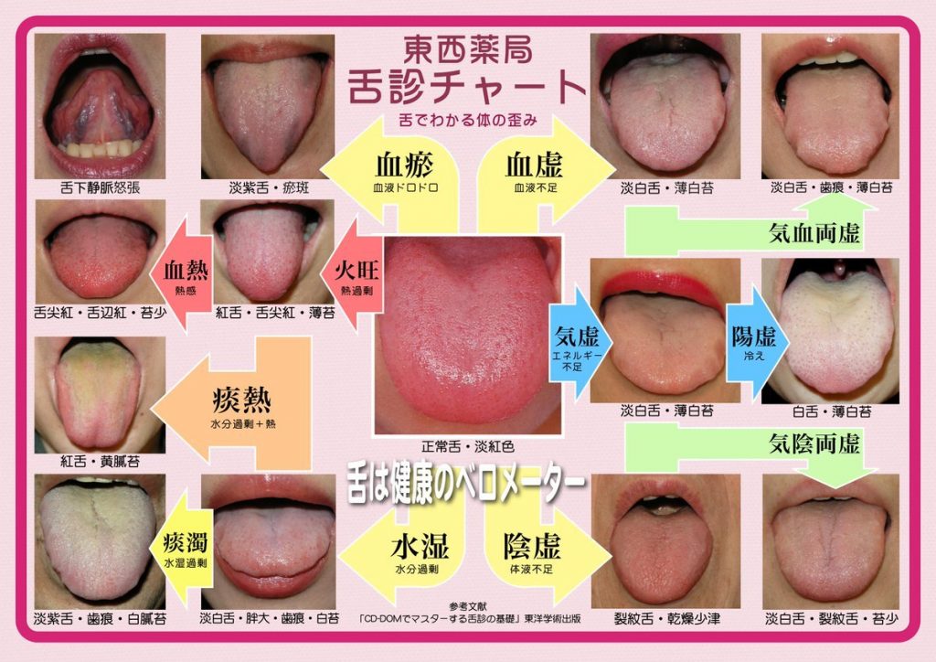 舌診チャート