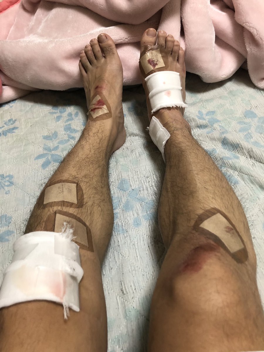 名古屋市中川区の春田駅近辺でひき逃げ発生!犯人の特定のためにも拡散希望!